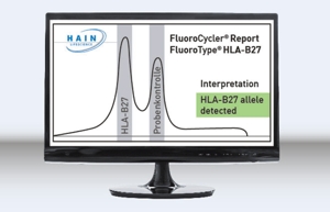 Ergebnisdarstellung FluoroType HLA-B27
