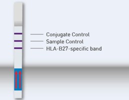 reaction zones GenoQuick HLA-B27 