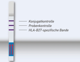 Streifengrafik GenoQuick HLA-B27