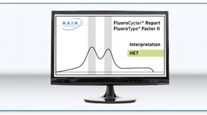 Display of result FluoroType® Factor II